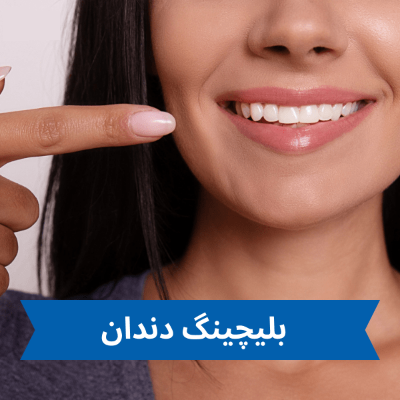 بلیچینگ دندان